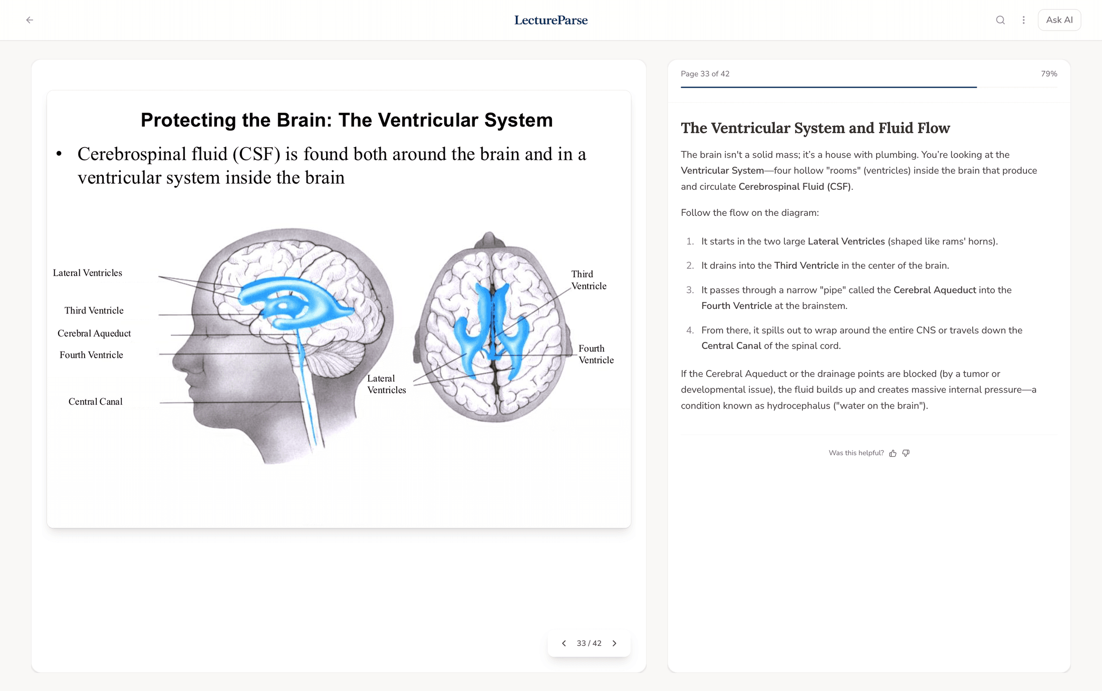 Every slide, explained